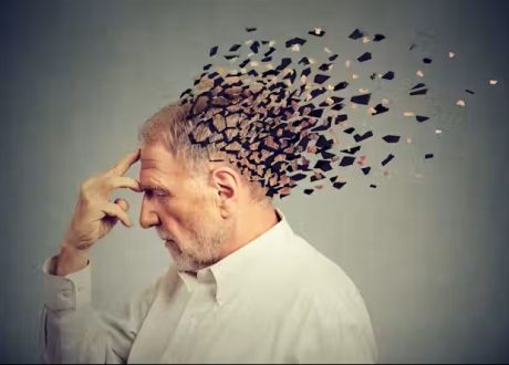 Alzheimer