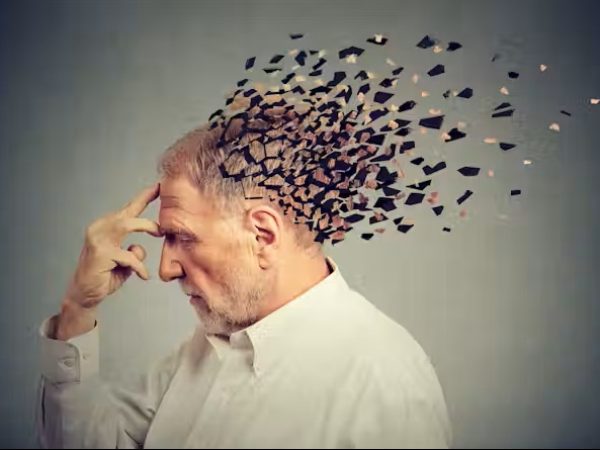 Alzheimer