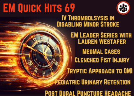 EM-Quick-Hit 69