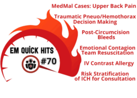 EM-Quick-Hits-70-CARD-320x240