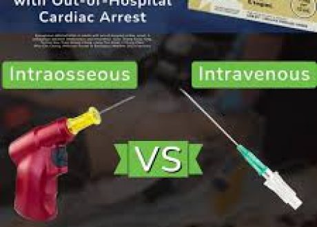 Intraosseous vs Intravenous Access for Epinephrine