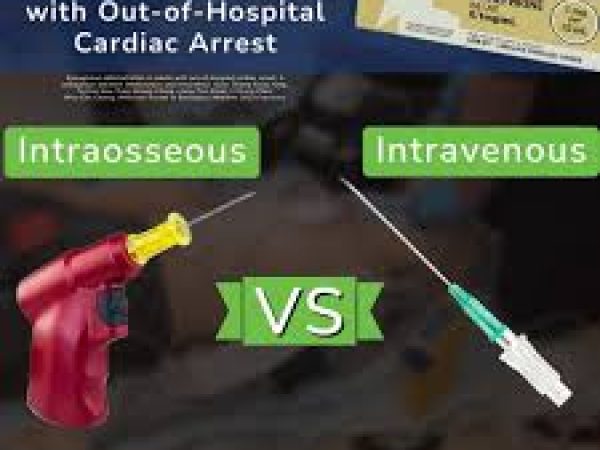 Intraosseous vs Intravenous Access for Epinephrine