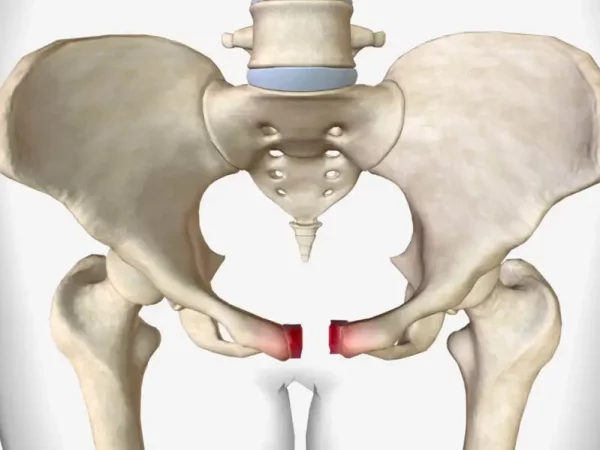 Pelvic-Fracture