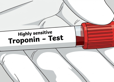 high sen troponinpng