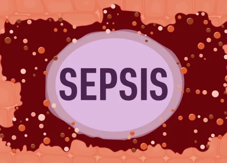 sepsis