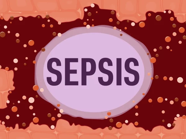 sepsis