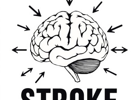 stroke