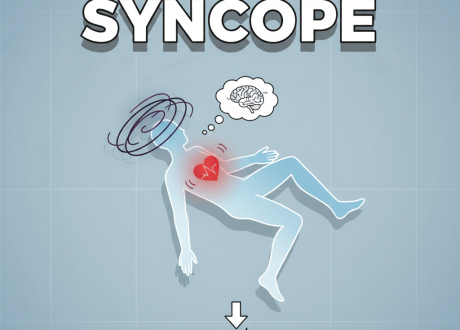 syncope