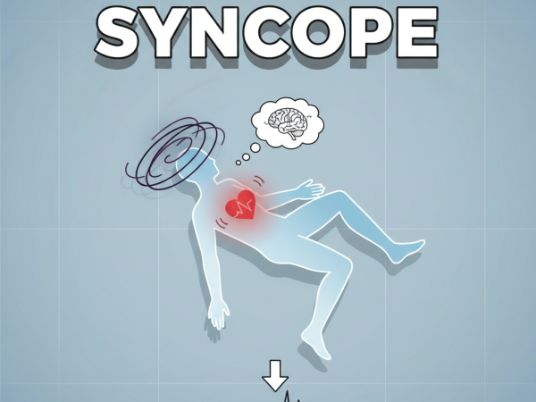 syncope