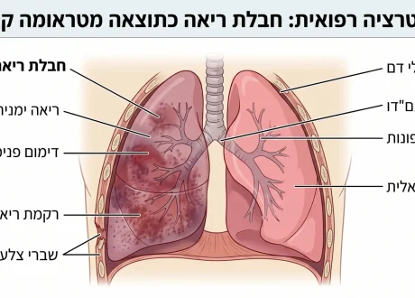 טראומה לריאה